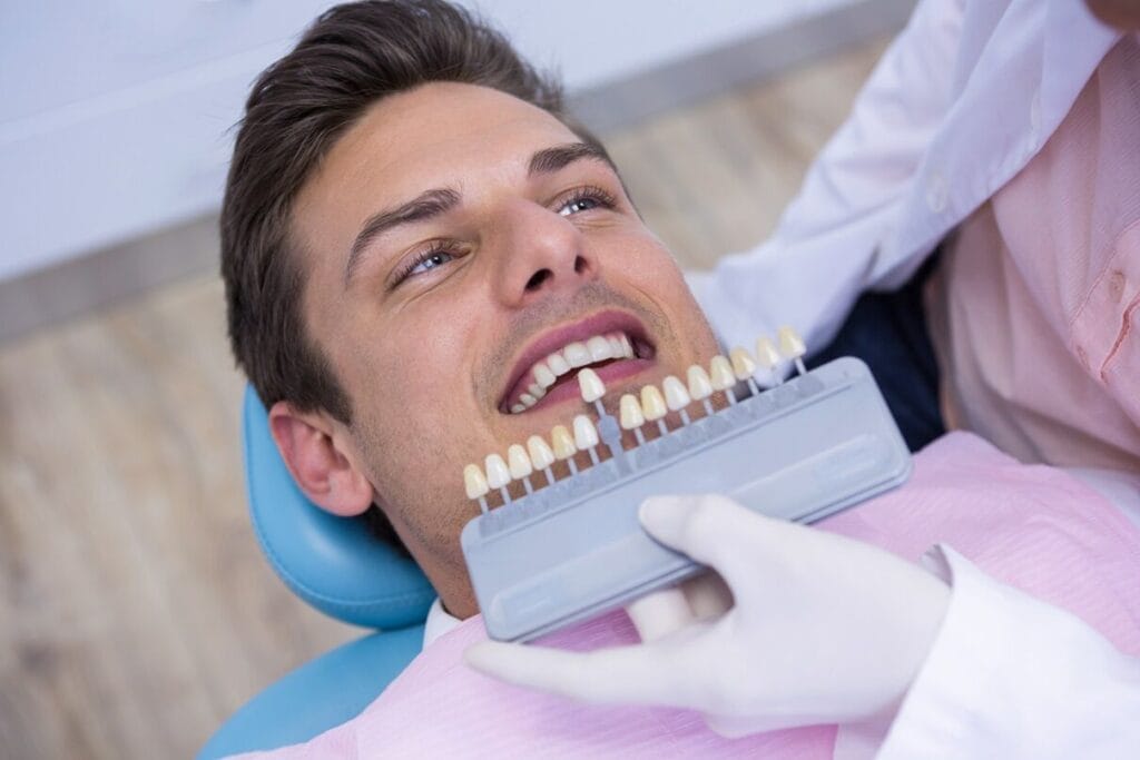Cosa sono le faccette dentali? Qual è il loro scopo? 8 Cosa sono le faccette dentali Qual e il loro scopo