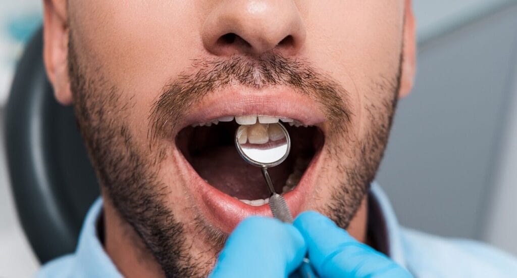 Qual è la causa di quella macchia scura sul tuo dente? 7 Qual e la causa di quella macchia scura sul tuo dente