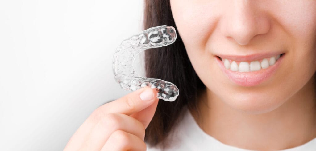 4 cose da sapere prima di mettere l'apparecchio da adulto 1 Vident