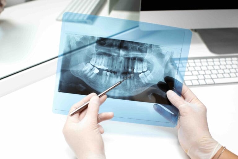 News 3 Procedura impianto dentale