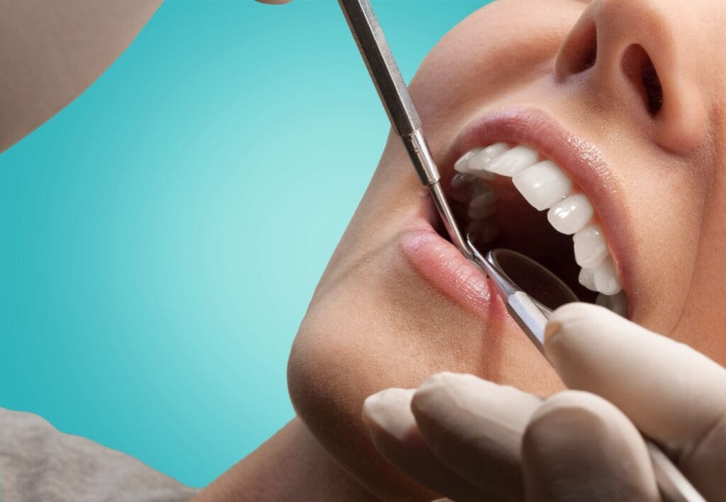 Glossario Odontoiatria Estetica 1 Glossario odontoiatria estetica