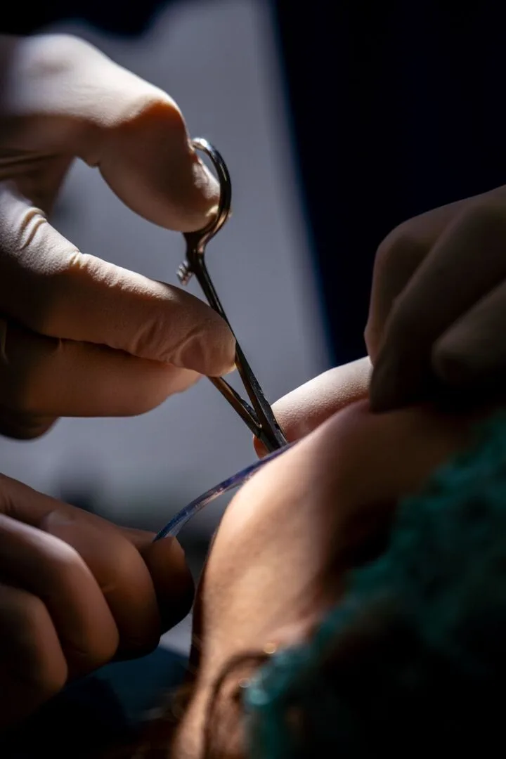 Chirurgia Orale 3 estrazione dente del giudizio a Bagnolo Mella
