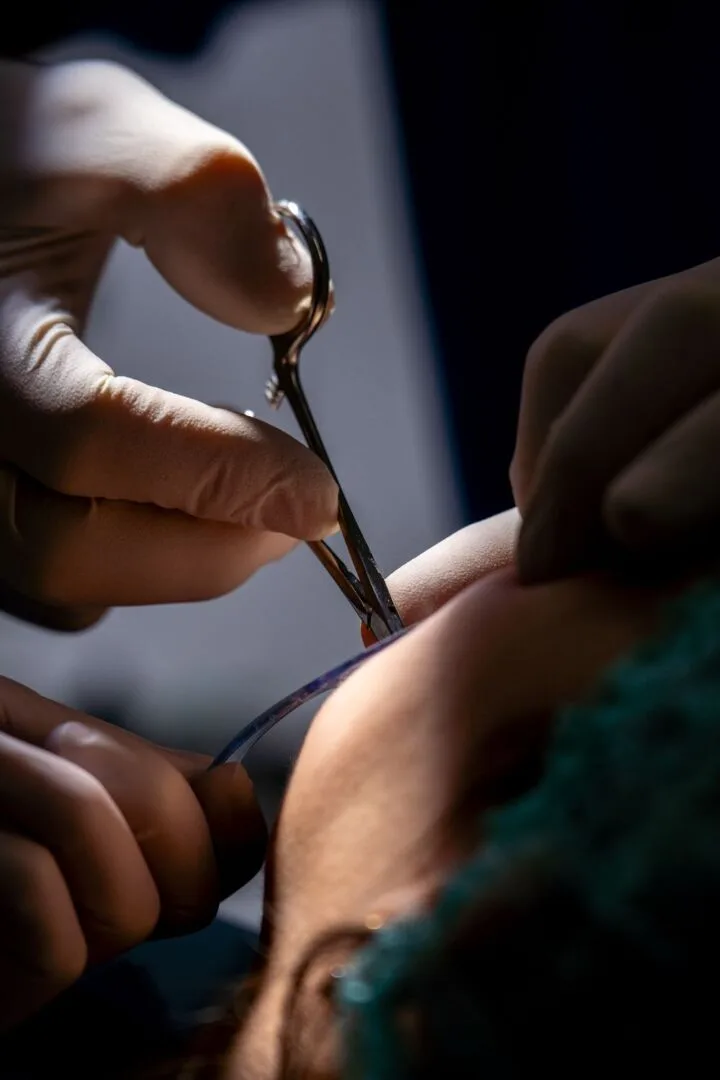 Endodonzia 1 devitalizzazione dente a Bagnolo Mella