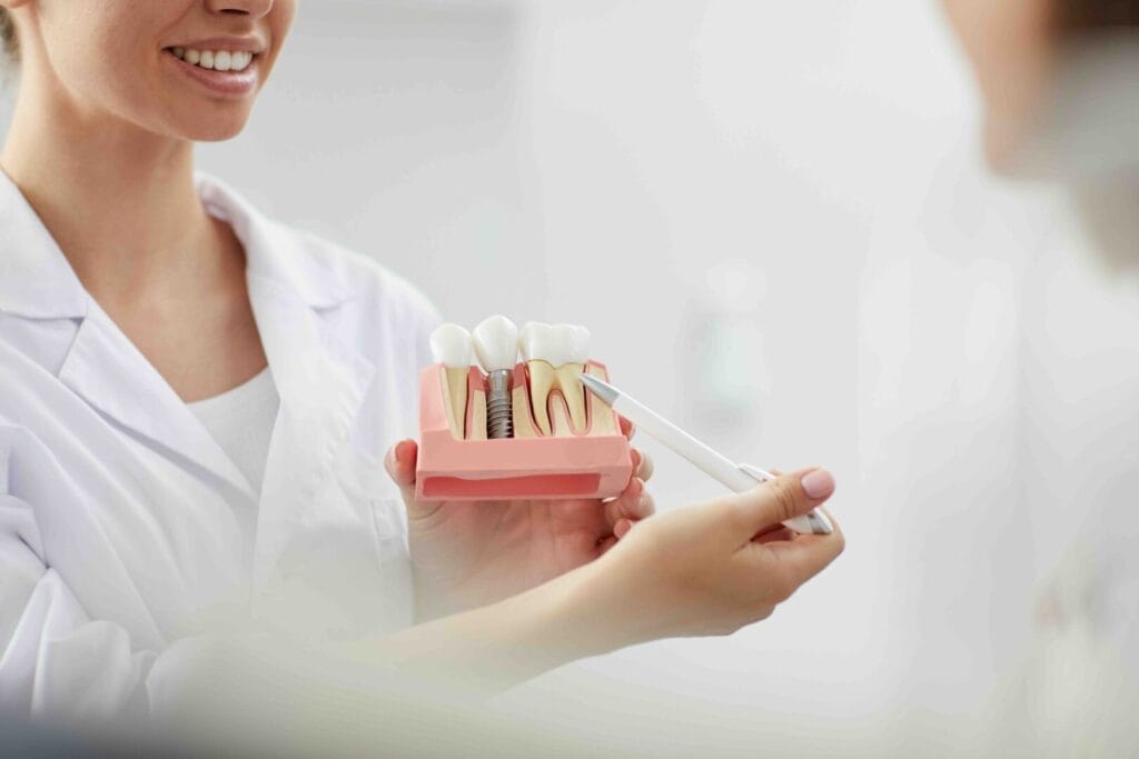 Come si fa un impianto dentale: guida completa 1 Come si fa un impianto dentale